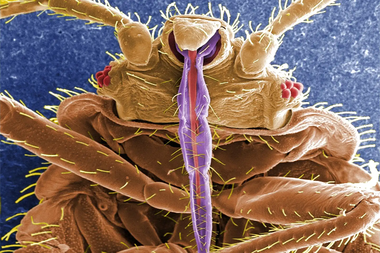 Scanning electron microscope detail of a bed bug underside, the anatomy behind the resilience Daytona Beach FL treatment programs have to beat